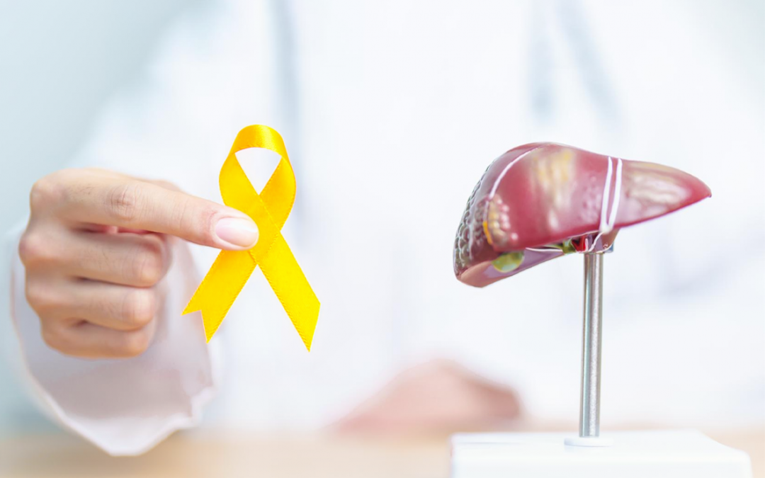 Julho Amarelo: o que você precisa saber para proteger a saúde do seu fígado