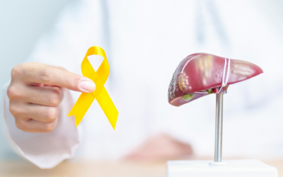 Julho Amarelo: o que você precisa saber para proteger a saúde do seu fígado